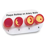 Nasco Artery Section Model with Blockage - WA09742U - 1 Each - MDL-NSCWA09742U