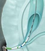 Olympus America Olympus CleverCut Sphincterotomes - OLPV411M0320