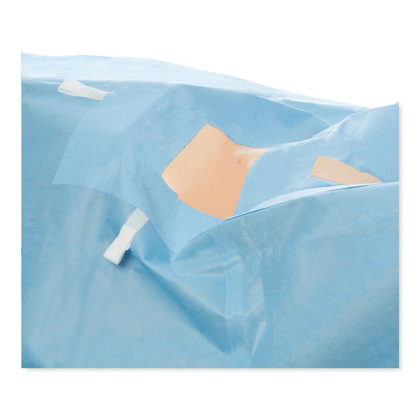 Halyard Laparoscopy Drapes - 79222 - 22 Each - MDL-OML79222