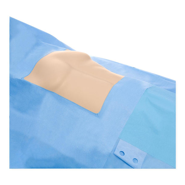 Halyard Chest Drapes - 79339 - 17 Each - MDL-OML79339