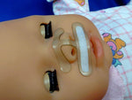 SUNMED Septal-H Gentle Cannula Stabilization Devices 5510A 20 Each-MDL-PBDCP5510A