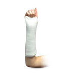 PARKER MEDICAL ASSOCIATES LLC Splint Roll Form Splinting System PS6L2 2 Roll - MDL-PMBPS6L2