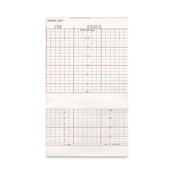 Print Media Corporation ECG / EKG Chart Paper Rolls and Sheets V960715 ...