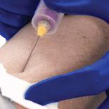 Ansell Healthcare Micro-Touch Micro-Thin Nitrile Exam Gloves 6034313 - 3000.0 Each