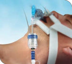 SMITHS MEDICAL SecureEasy Endotracheal Tube Holders 242003 1 Each - MDL-PTX242003H
