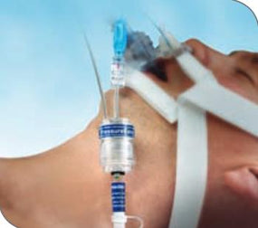 SMITHS MEDICAL SecureEasy Endotracheal Tube Holders 242003 1 Each - MDL-PTX242003H