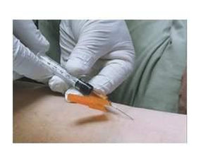 SMITHS MEDICAL Smiths Blood Draw Hypodermic Needles 4273 1 Each - MDL-PTX4273H