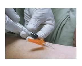SMITHS MEDICAL Smiths Blood Draw Hypodermic Needles 4273 1 Each - MDL-PTX4273H