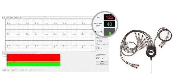 VectraplexECG System - V100002 - 1 Each - MDL-QRSV100002