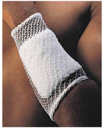 DEROYAL Stretch Net Tubular Elastic Bandage 1918529 1 Each - MDL-QTX107152