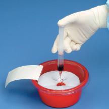 SplashStop Waste Collection Bowls by DeRoyal - 77-301370N - 100 Each - MDL-QTX77301370N