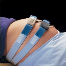 DEROYAL Fetal Monitoring Straps M1140 50 Each - MDL-QTXM1140