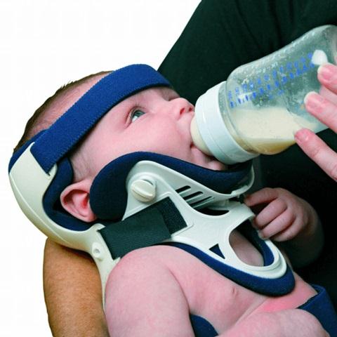 Ossur Americas Inc Papoose Infant Immobilizer PO-100 - 1.0 Each