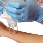 SplashCap Wound Irrigation Shields - 10015 - 25 Each - MDL-SCS10015