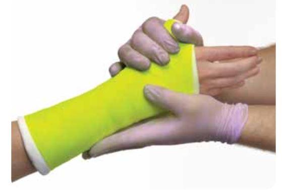BSN MEDICAL INC Delta-Lite Conformable Fiberglass Cast 6601 10 Roll-MDL-SCS6601