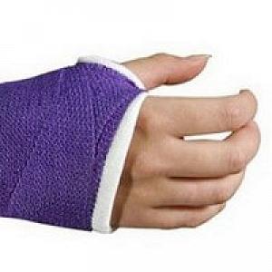 Bsn Medical Delta-Cast Conformable Fiberglass-Free Cast, 4" x 4yd., Black - SCS7214