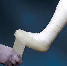 BSN MEDICAL INC Cutimed Off-Loader Cast Systems 7800901 1 Each - MDL-SCS7800901