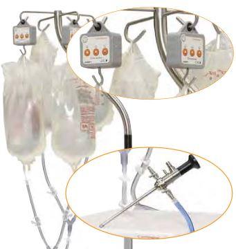Smith Nephew Multi-Bag Y-Tubing Multibag Irrigation Adapter for Dyonics 25 Fluid Management System - SDY7204483