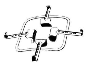 Sklar Sklar Fixed Frame Kirschner Retractors 60-7200 - 1.0 Each - MDL-SKA607200