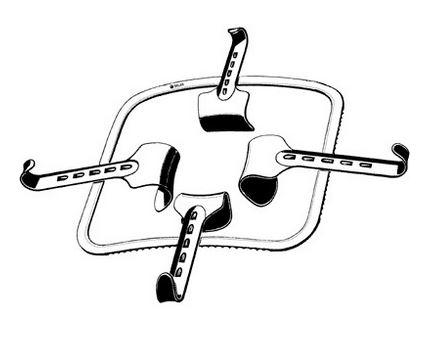 Sklar Sklar Fixed Frame Kirschner Retractors 60-7200 - 1.0 Each - MDL-SKA607200