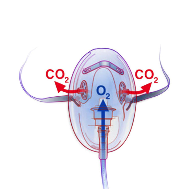 Salter Labs CapnoVue CO2 and O2 Masks - 4723-7-0-50 - 50 Each - MDL-SLT47237050