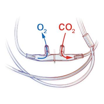 Adult, O2/EtCO2 Filtered Oral/Nasal Divided Cannula, 2" O2 Line, 13' EtCO2 Line - 4MSF1-0-13-25 - 25 Each