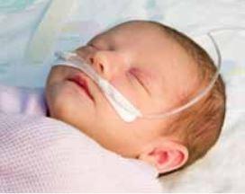 SALTER LABS Sticky-Whiskers Infant Cannula Holder SW102-0-25 25 Each-MDL-SLTSW102025