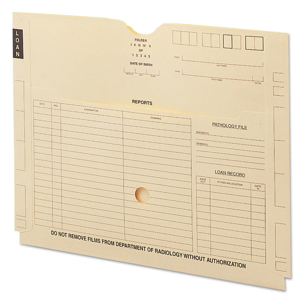 SMEAD MANUFACTURING CO. X-Ray End Tab File Jacket with Pocket 66300 100 Each-MDL-SMD66300