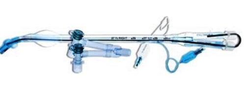 Robertshaw Dual Lumen Trach Tubes - 1-7370-35 - 1 Each - MDL-SMI1737035