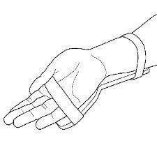Semler Technologies WristAssist Compression System Aid 140-0300-00 - 1.0 Each