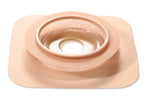 Convatec ConvaTec Natura Durahesive Moldable Skin Barriers 421033 - 10.0 Each - MDL-SQU421033