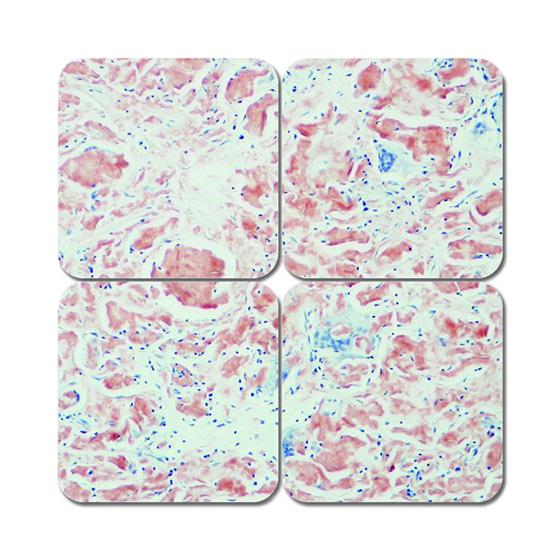 STATLAB MEDICAL PRODUCTS INC Alkaline Congo Red Amyloid Stain Kit KTACR 1 Each-MDL-STLKTACR