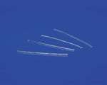 Shunt Kit for Carotid Artery with Looped Tube, Argyle - 8888577775 - 1 Each