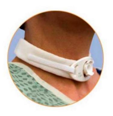 Marpac Pediatric and Neonatal Tracheostomy Collar, Size 1, Pediatric/Neonatal - 506-203D - 10 Each