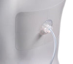 URESIL LLC TRU-FIX Catheter Fixation Device TFK-12 5 Each - MDL-URLTFK12