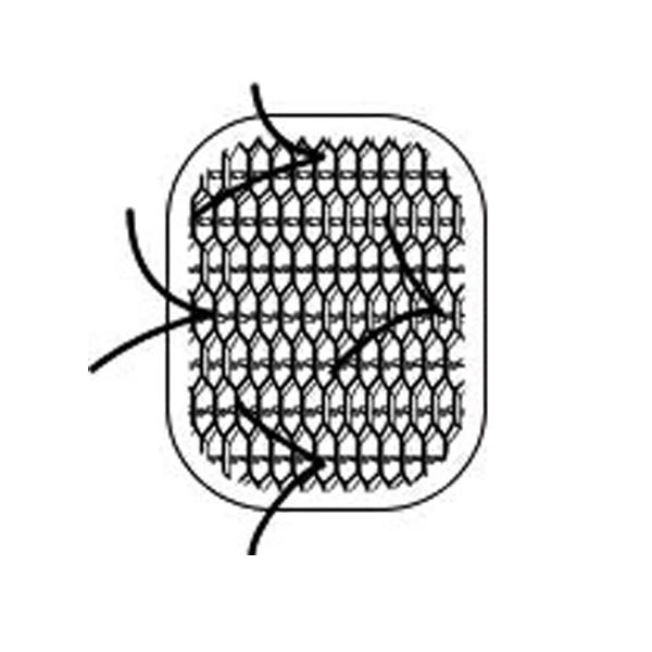 Parietex Optimized Composite PCOx/PCO OSx Open Skirt Mesh - PCO3020X - 1 Each - MDL-USUPCO3020X
