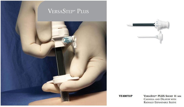 VersaStep Plus Bladeless Trocars with Radially Expandable Sleeve - VS101011P - 1 Each - MDL-USUVS101011PH