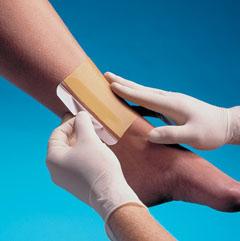 Smith Nephew Replicare Hydrocolloid Dressing, 4" x 4" - 483100 - 5 Each
