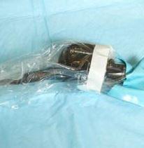 Closed-System Camera Drapes - VCD5116 - 25 Each - MDL-VCRVCD5116