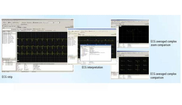 CardioPerfect Software & Updates - 101524 - 1 Pack - MDL-W-A101524