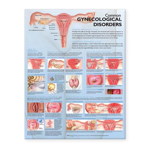 Wolters Kluwer Gynecological Disorders Anatomical Chart 9780781773508 - 1.0 Each
