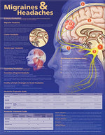 Wolters Kluwer Migraines and Headaches Anatomical Chart, Laminated - 9780781776608 - 1 Each