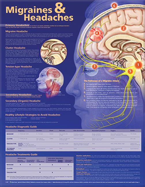 Wolters Kluwer Migraines and Headaches Anatomical Chart, Laminated - 9780781776608 - 1 Each