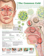 Wolters Kluwer Understanding the Common Cold Anatomical Chart 9780781786300 - 1.0 Each