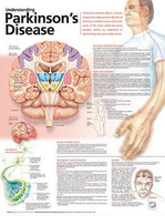 Wolters Kluwer Understanding Parkinson's Disease Anatomical Chart 9780781786362 - 1.0 Each