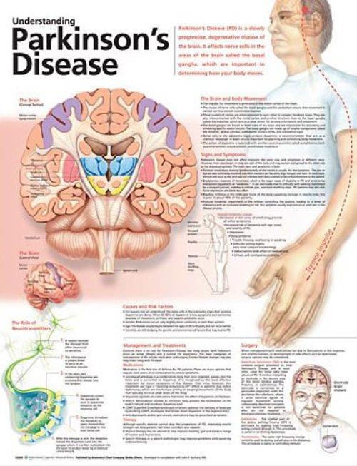Wolters Kluwer Understanding Parkinson's Disease Anatomical Chart 9780781786362 - 1.0 Each