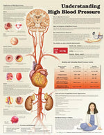 Wolters Kluwer Understanding High Blood Pressure Anatomical Chart, Paper - 9781469872889 - 1 Each