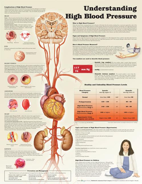 Wolters Kluwer Understanding High Blood Pressure Anatomical Chart, Paper - 9781469872889 - 1 Each
