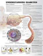 Wolters Kluwer Understanding Diabetes Anatomical Charts 9781469894928 - 1.0 Each