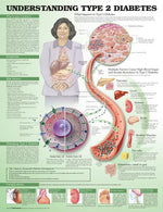 Wolters Kluwer Understanding Diabetes Anatomical Charts 9781469894980 - 1.0 Each